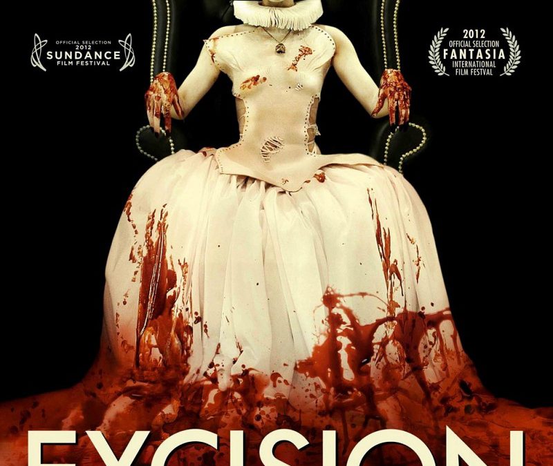 Excision